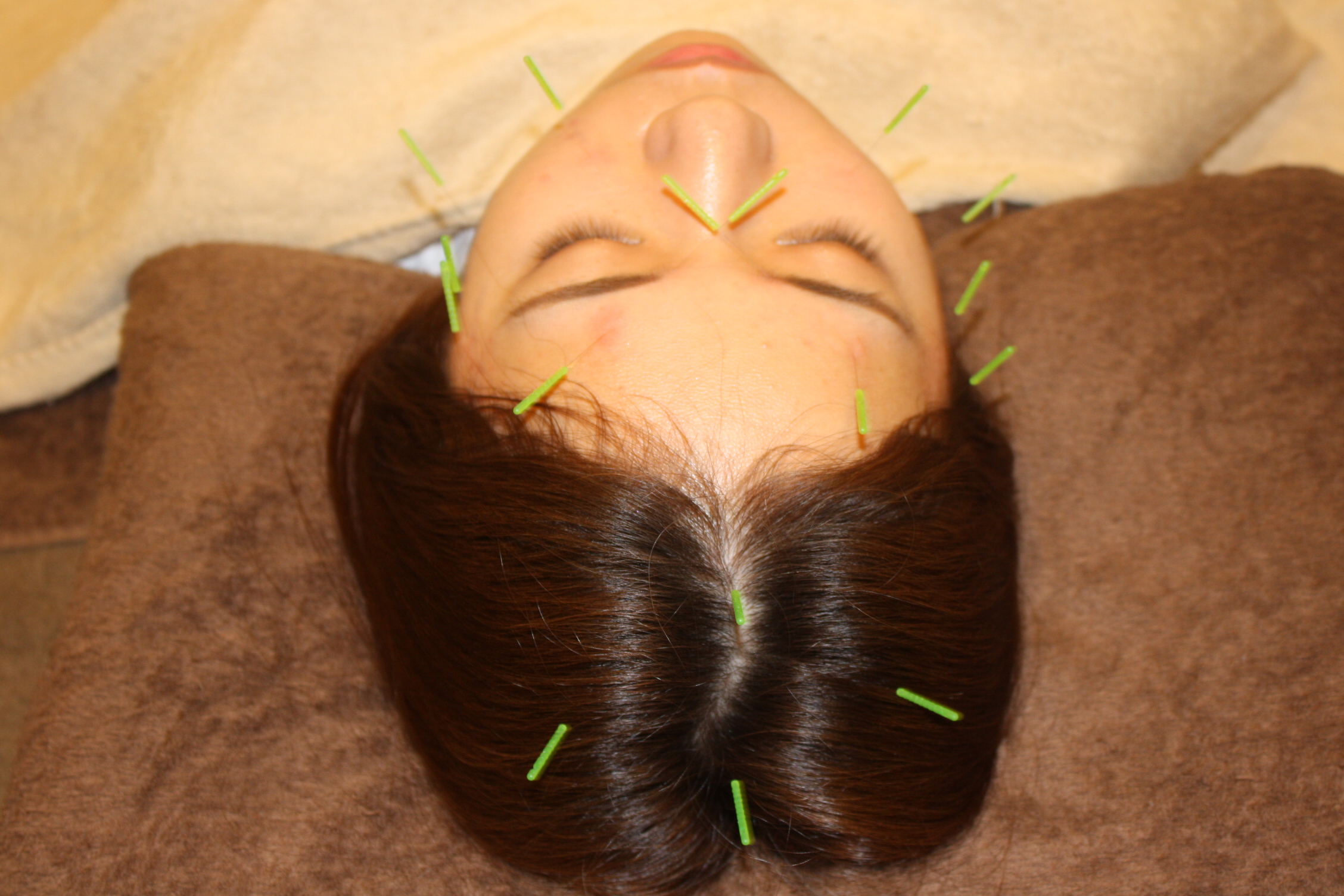 頭が重いのに検査で異常なし ― 非器質性頭重感