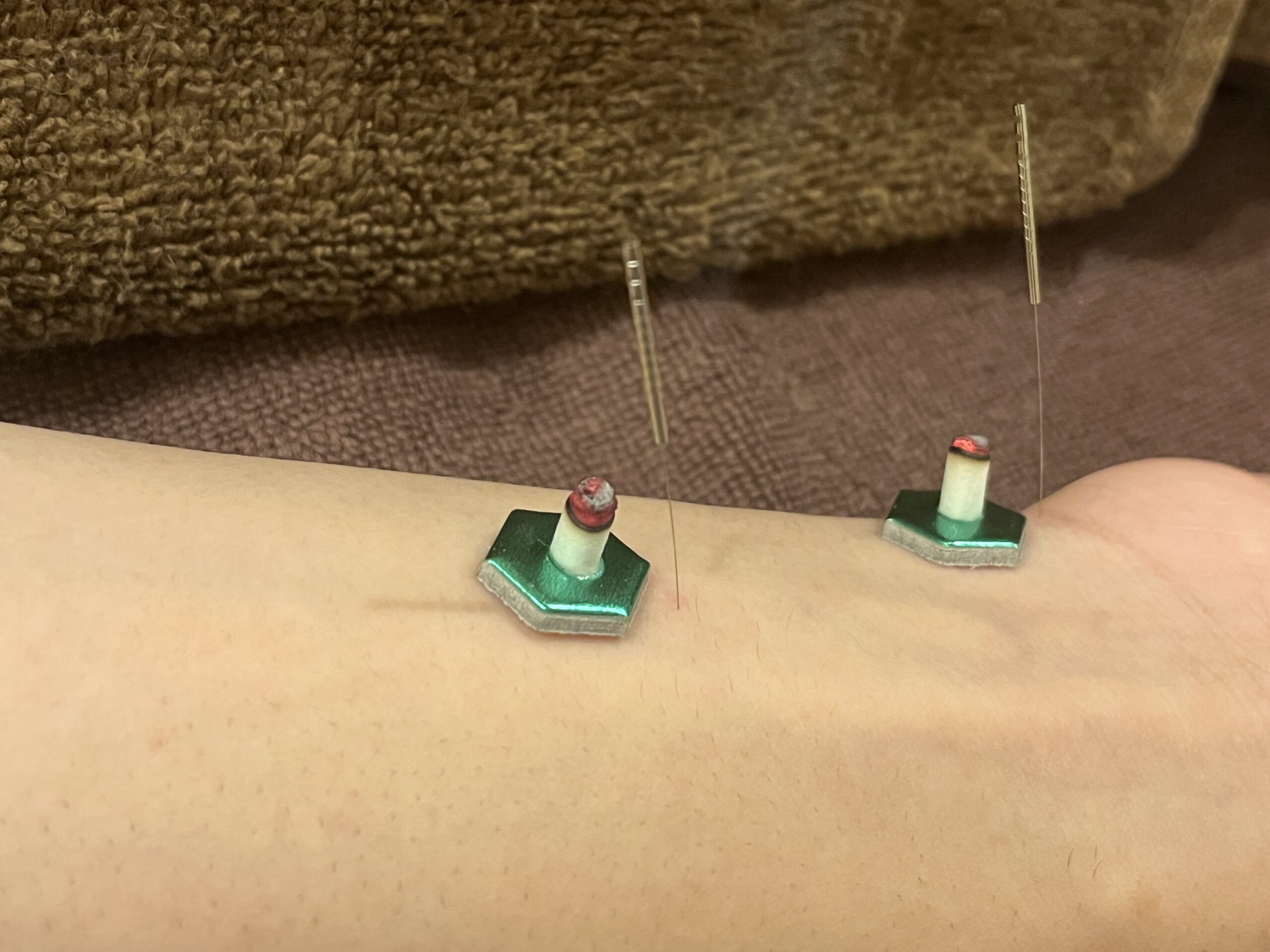 手が震える「振戦（しんせん）」